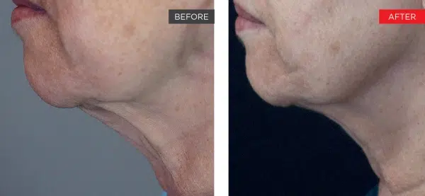 66fac81bc46f464094e15dae_courtesy_of_h_shiffman_md