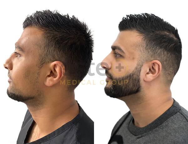 670e46c072bad0b8b41a1386_Shafeeq-1