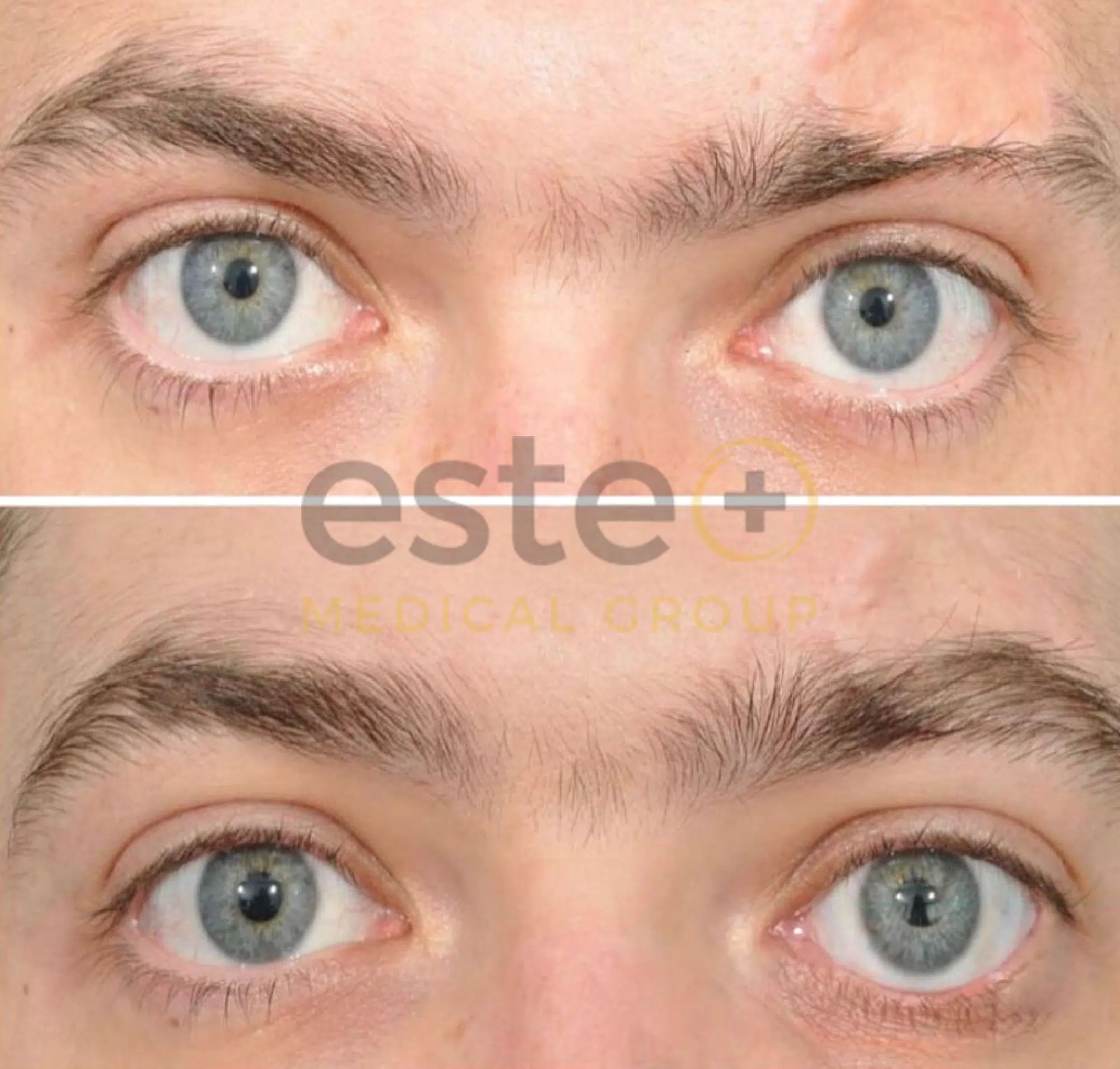 670f5f274e9bfff84a033c82_Edited Eyebrow-2-p-2000