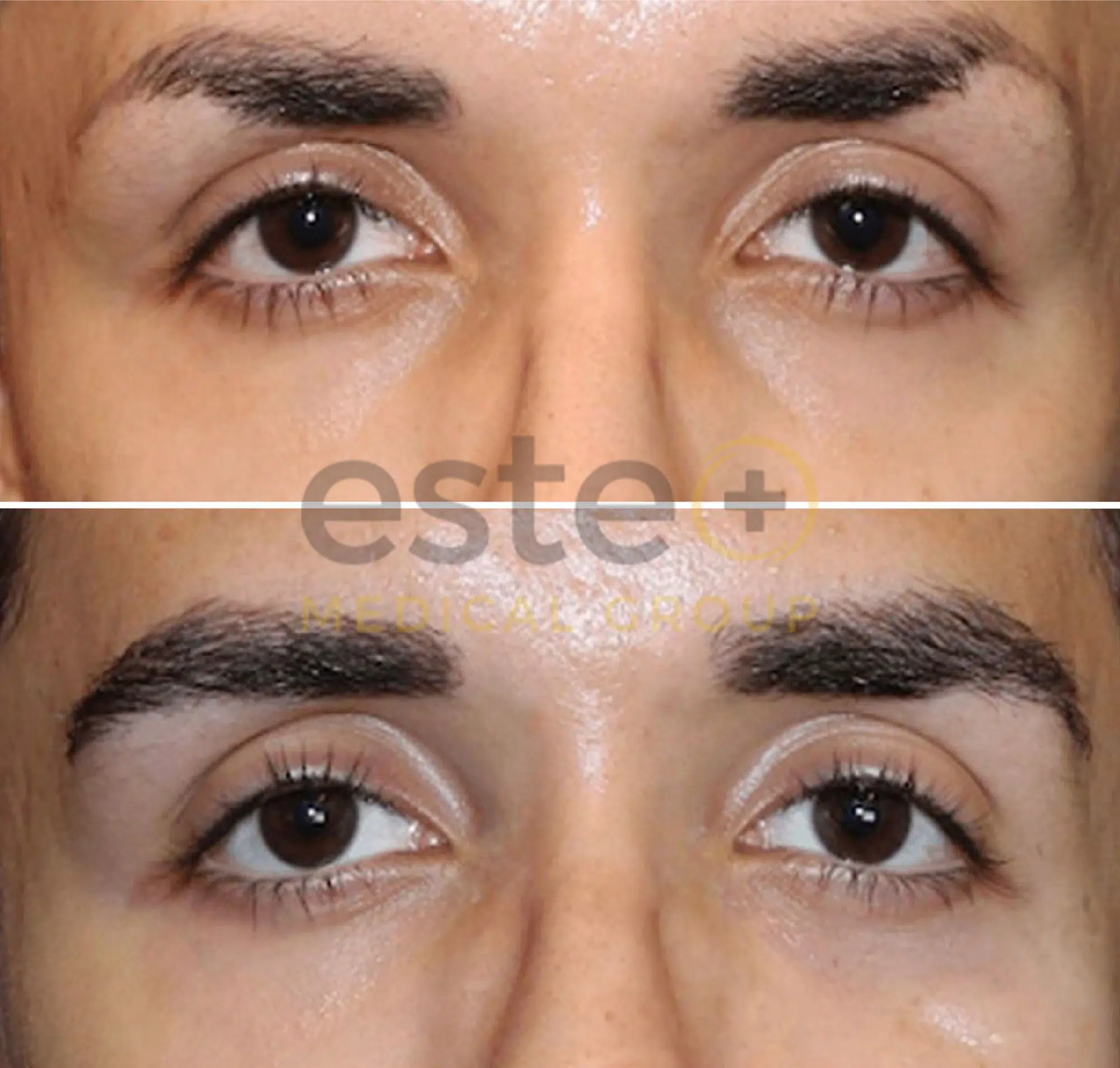 670f5f288b542ae7c7baae14_Edited Eyebrow-1-p-2000
